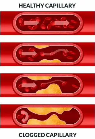 Boostaro cardiovascular support supplement